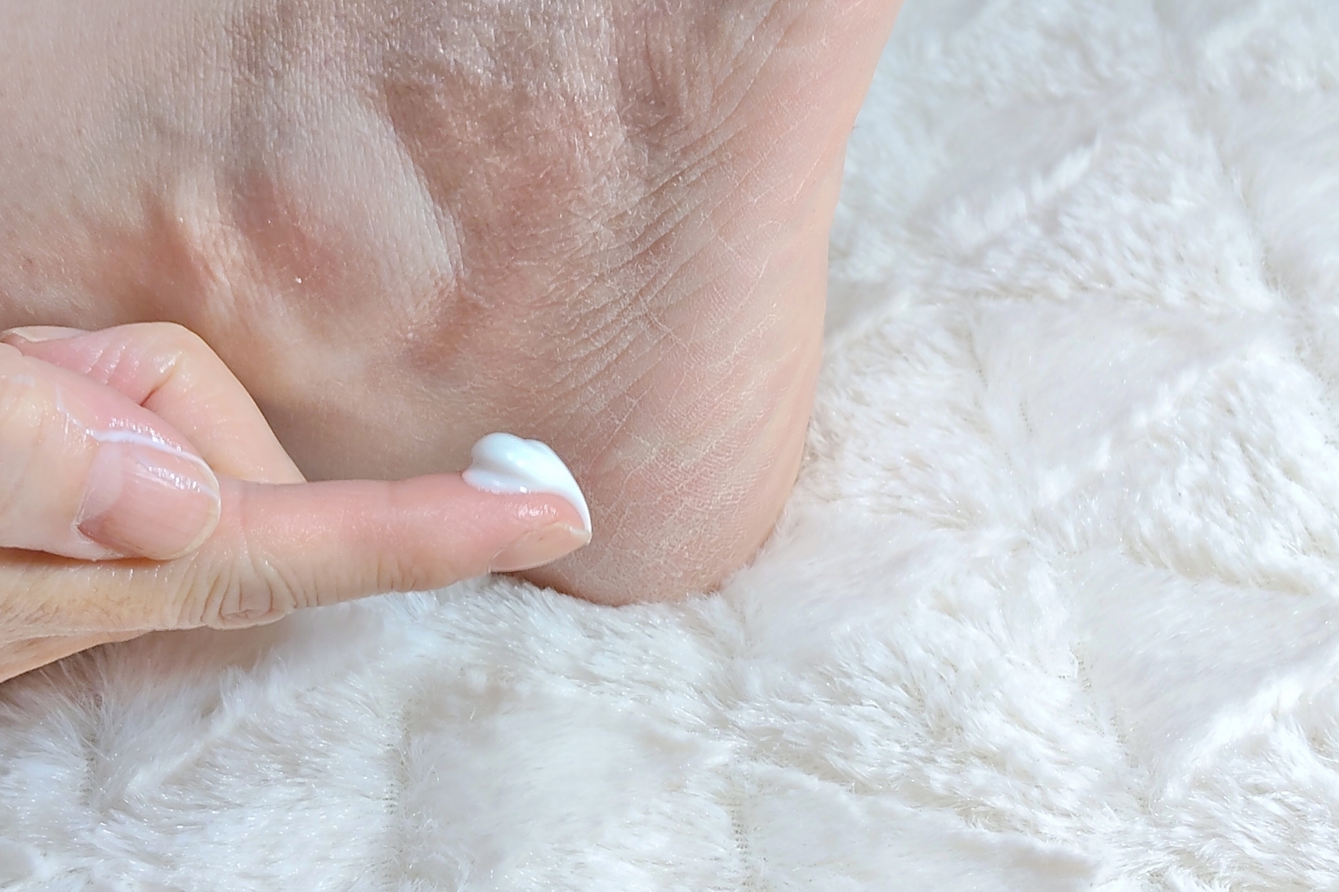 かかとに保湿クリームを塗る様子